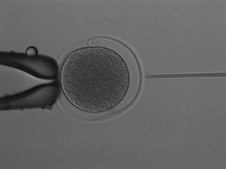 Scientists have produced a kangaroo embryo through IVF. It has sparked hope for marsupial conservation